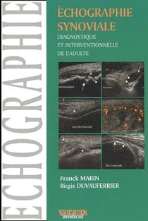 Échographie synoviale - diagnostique et interventionnelle de l'adulte