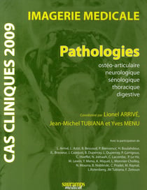 Cas cliniques 2009 - imagerie médicale - pathologies osthéo-articulaire, neurolo, seinolo, thorac. digestive