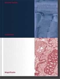 Simone decker : implantate. magnificatio