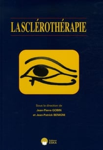 La sclérothérapie