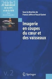 IMAGERIE EN COUPES DU COEUR ET DES VAISSEAUX