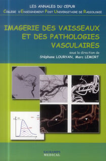 Imagerie des vaisseaux et des pathologies vasculaires