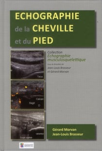 Échographie de la cheville et du pied