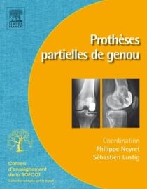 Prothèses partielles du genou
