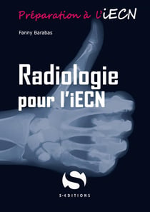 Préparer l'iECN : radiologie pour l'iECN