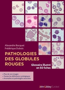 Pathologies des globules rouges : Glossaire illustré en 50 fiches