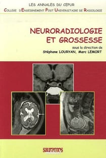 Neuroradiologie et grossesse
