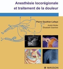 Anesthésie locorégionale et traitement de la douleur (4e édition)