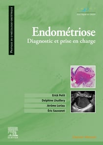 Endométriose - diagnostic et prise en charge