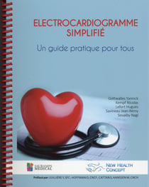 Électrocardiogramme simplifié - un guide pratique pour tous