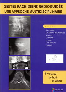 Gestes rachidiens radioguides - une approche