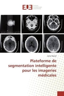 Plateforme de segmentation intelligente pour les imageries médicales