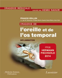 Imagerie de l'oreille et de l'os temporal Tome 2 - inflammation