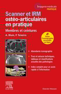 Scanner et IRM ostéo-articulaires en pratique : membres et ceintures