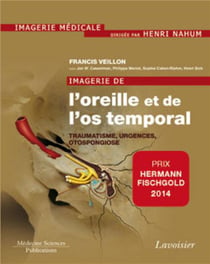 Imagerie de l'oreille et de l'os temporal Tome 3 - traumatisme, urgences, otospongiose