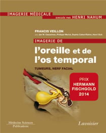 Imagerie de l'oreille et de l'os temporal Tome 4 - tumeurs, nerf facial