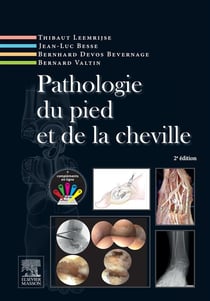 Pathologie du pied et de la cheville (2e édition)