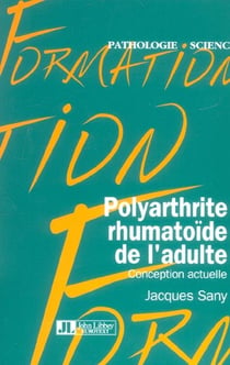 Polyarthrite rhumatoide de l'adulte. conception actuelle