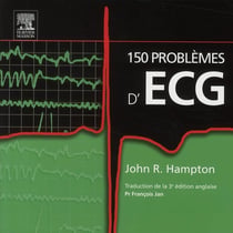 150 problèmes d'ECG