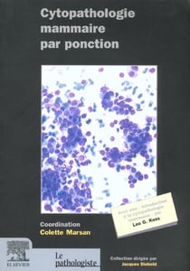 Cythopathologie des lesions du sein
