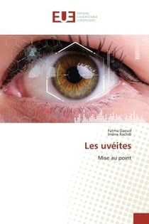 Les uvéites : Mise au point