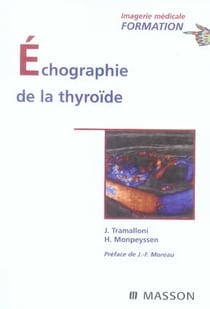 Échographie de la thyroïde