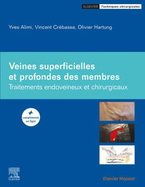 Veines superficielles et profondes des membres : traitements endoveineux et chirurgicaux