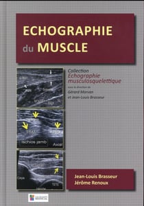 Échographie du muscle