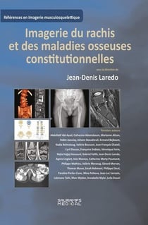 Imagerie du rachis et des maladies osseuses constitutionnelles : Rachis de l'adulte et maladies osseuses de l'enfant vues à l'âge adulte