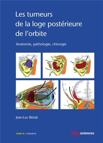 Les tumeurs de la loge postérieure de l'orbite Tome 3