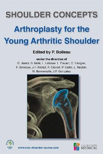 Shoulder concepts - arthroplasty for the young arthritic shoulder