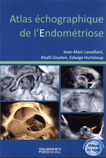 Atlas échographique de l'endométriose
