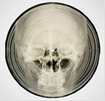 Bone music: soviet x-ray audio