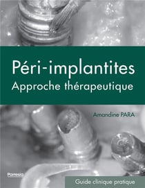 Péri-implantites - approche thérapeutique - guide clinique pratique