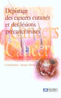Depistage cancers cutanes lesions precancer