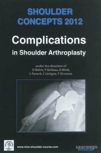 Shoulder concepts 2012 - complications in shoulder arthroplasty