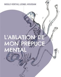 L'ablation de mon prepuce mental