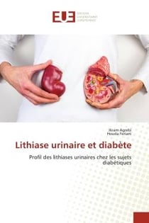 Lithiase urinaire et diabète : Profil des lithiases urinaires chez les sujets diabétiques