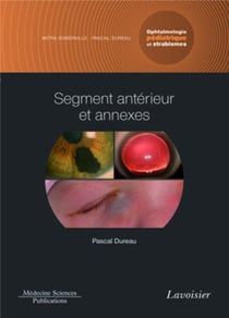 Ophtalmologie pédiatrique et strabismes Tome 2 - segment antérieur et annexes