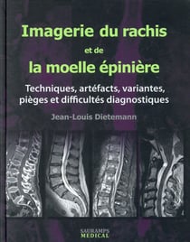 Imagerie du rachis et de la moelle épinière - techniques, artefacts, variantes, pièges et difficultés diagnostiques