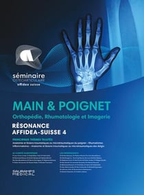 Résonance diagnostic en imagerie rhumatologique : Main & poignet : Orthopédie, rhumatologie - imagerie - résonance Affidea Suisse 4
