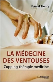 La médecine des ventouses - cupping-thérapie medicine