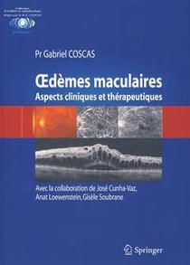 OEDEMES MACULAIRES
