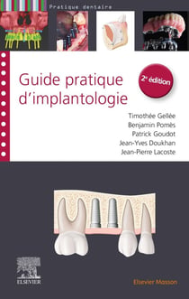 Guide pratique d'implantologie (2e édition)