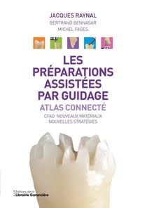 Les préparations assistées par guidage : Atlas connecté