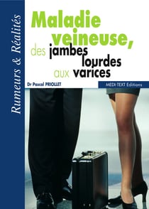 Maladie veineuse, des jambes lourdes aux varices