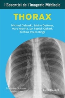 Thorax - l'essentiel de l'imagerie médicale