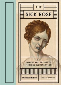 The sick rose disease and the art of medical illustration