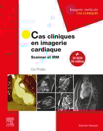 Cas cliniques en imagerie cardiaque - scanner et IRM