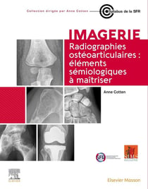 Imagerie : radiographies ostéoarticulaires : éléments sémiologiques à maîtriser